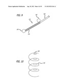 Extra-Articular Implantable Load Sharing Systems diagram and image