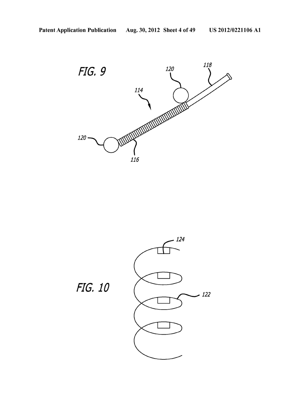 Extra-Articular Implantable Load Sharing Systems - diagram, schematic, and image 05