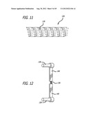 Extra-Articular Implantable Load Sharing Systems diagram and image