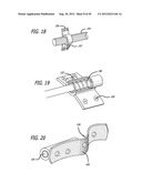 Extra-Articular Implantable Load Sharing Systems diagram and image