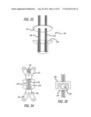 Extra-Articular Implantable Load Sharing Systems diagram and image