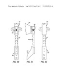 Extra-Articular Implantable Load Sharing Systems diagram and image