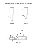 Extra-Articular Implantable Load Sharing Systems diagram and image