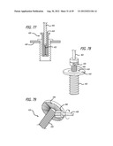 Extra-Articular Implantable Load Sharing Systems diagram and image