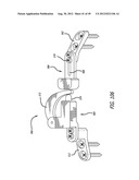 Extra-Articular Implantable Load Sharing Systems diagram and image