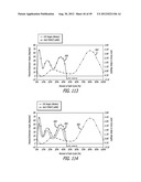 Extra-Articular Implantable Load Sharing Systems diagram and image