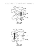 Extra-Articular Implantable Load Sharing Systems diagram and image