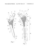 HIP STEM PROSTHESIS diagram and image