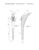 HIP STEM PROSTHESIS diagram and image