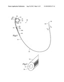 URETERAL STENT diagram and image