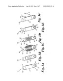 BONE FIXATED, ARTICULATED JOINT LOAD CONTROL DEVICE diagram and image