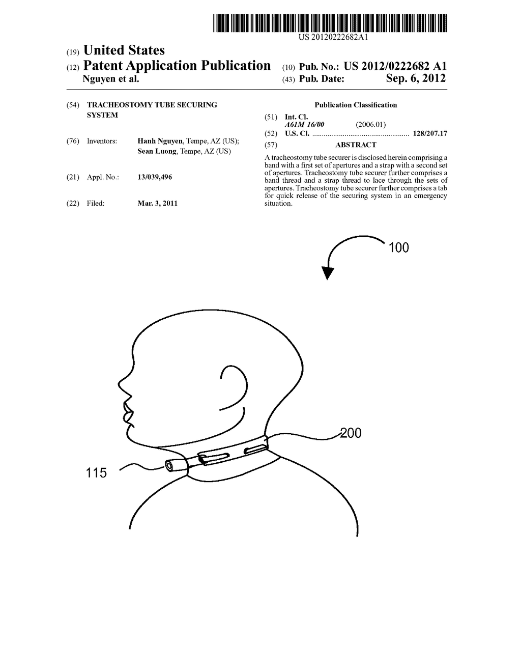 Tracheostomy Tube Securing System - diagram, schematic, and image 01