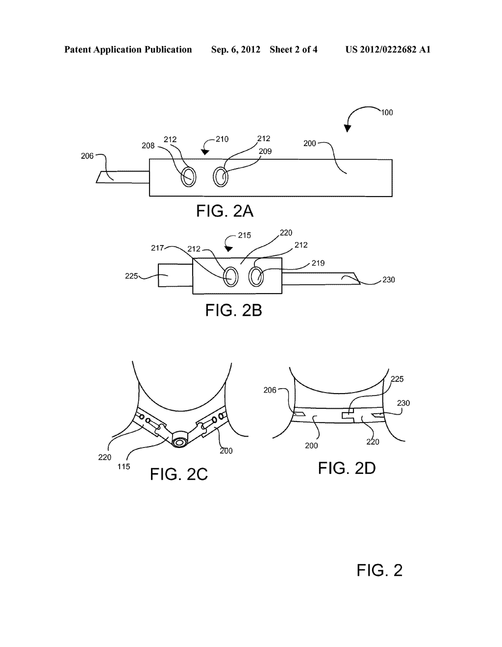 Tracheostomy Tube Securing System - diagram, schematic, and image 03