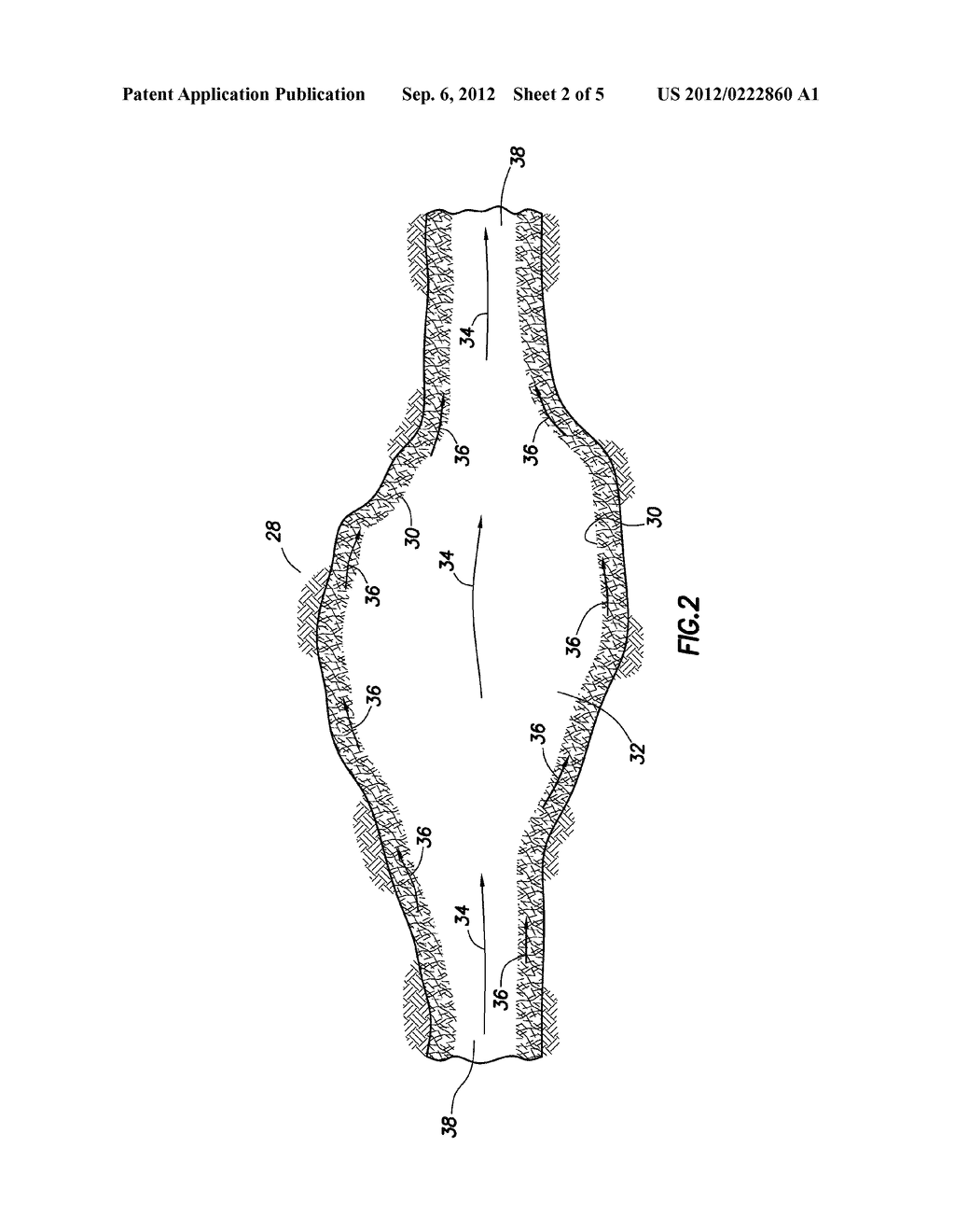 SELECTIVE PLACEMENT OF CONFORMANCE TREATMENTS IN MULTI-ZONE WELL     COMPLETIONS - diagram, schematic, and image 03