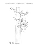 Lightweight Controlled Descent System with an Integral Reserve Suspension     Relief Strap (RSRS) diagram and image