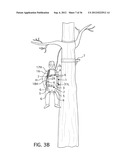 Lightweight Controlled Descent System with an Integral Reserve Suspension     Relief Strap (RSRS) diagram and image