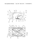 STENT AND METHOD OF FORMING A STENT WITH INTEGRAL BARBS diagram and image