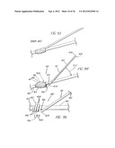 STENT AND METHOD OF FORMING A STENT WITH INTEGRAL BARBS diagram and image