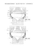 VALVE HAVING OPPOSED CURVED SEALING SURFACES ON A VALVE MEMBER AND A VALVE     SEAT TO FACILITATE EFFECTIVE SEALING diagram and image