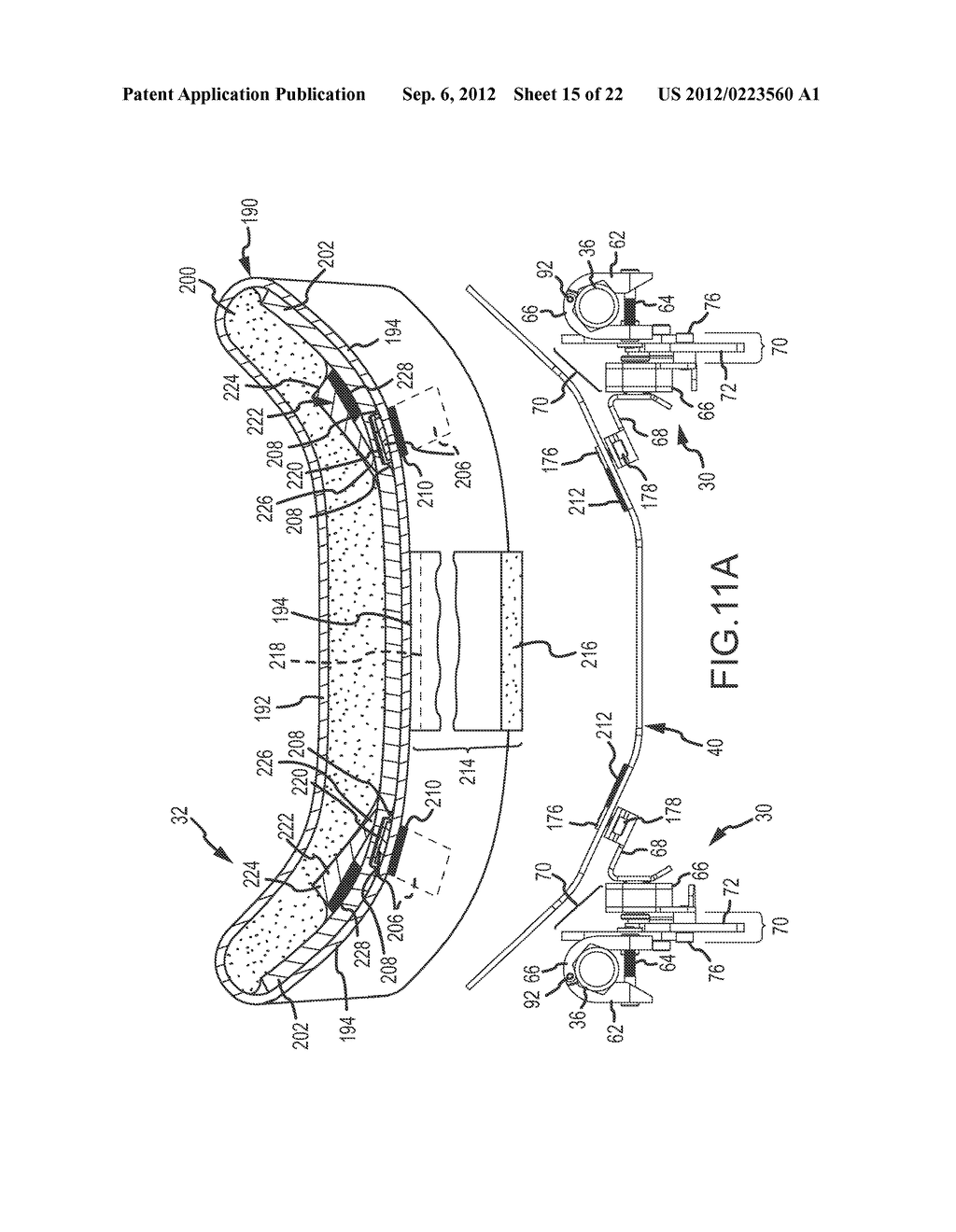 Back Support, Orientation Mechanism and Method - diagram, schematic, and image 16