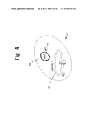 FLEXIBLE RESONATOR ATTACHMENT diagram and image