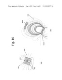 FLEXIBLE RESONATOR ATTACHMENT diagram and image