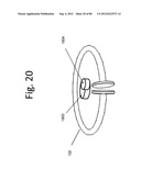 FLEXIBLE RESONATOR ATTACHMENT diagram and image