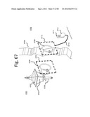 FLEXIBLE RESONATOR ATTACHMENT diagram and image