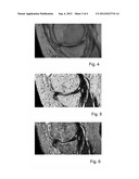 Method of generating 2D or 3D maps of MRI T1 and T2 relaxation times diagram and image