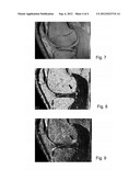 Method of generating 2D or 3D maps of MRI T1 and T2 relaxation times diagram and image