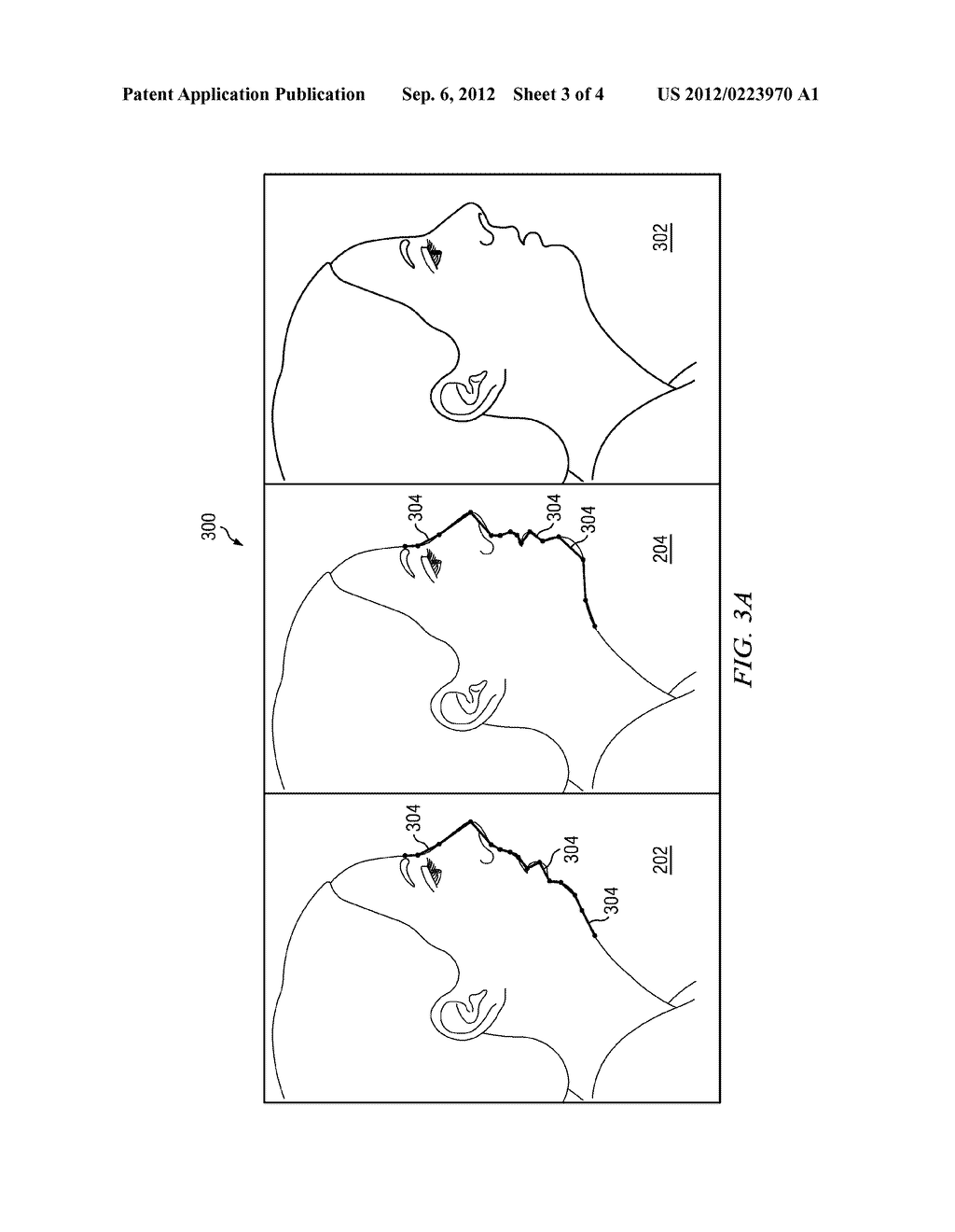 System and Method for Generating Profile Morphing Using Cephalometric     Tracing Data - diagram, schematic, and image 04