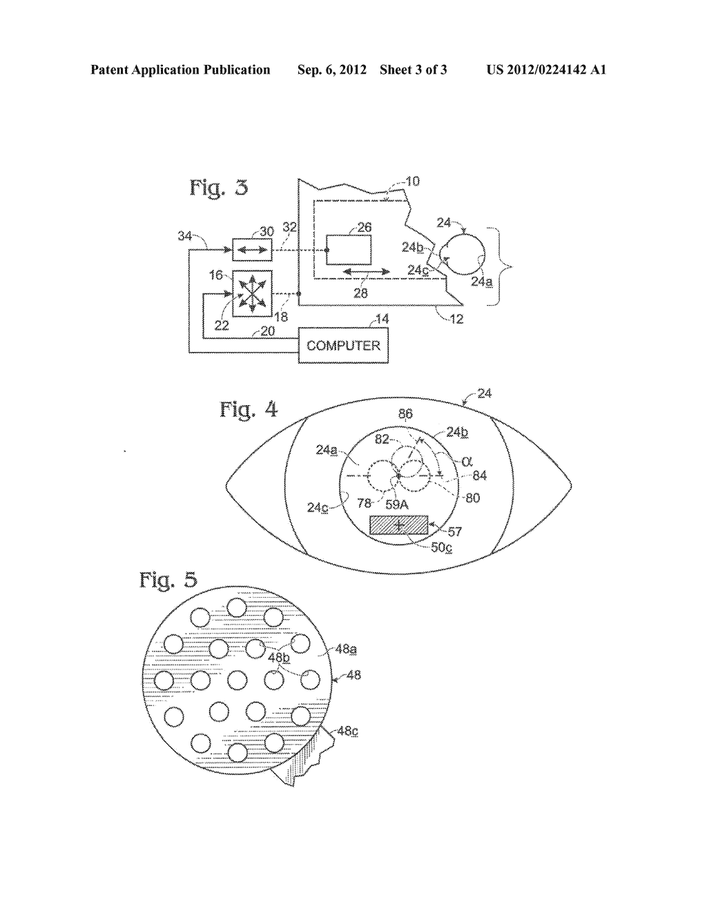 OCULAR FUNDUS CAMERA SYSTEM AND METHODOLOGY - diagram, schematic, and image 04