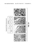 ANTI-MESOTHELIN ANTIBODIES AND IMMUNOCONJUGATES diagram and image