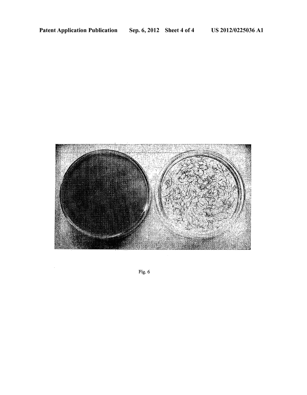 PLANKTON STRAIN ALGAE PARACHLORELLA NUREKIS 1904 KIEG AND HIS USE TO     EXTERMINATE CYANOBACTERIA, BACTERIA AND FUNGI - diagram, schematic, and image 05