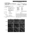 Isolation and Use of Melanoma Cancer Stem Cells diagram and image