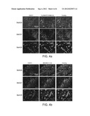 Isolation and Use of Melanoma Cancer Stem Cells diagram and image