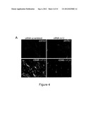 ADAM12 Inhibitors and Their Use Against Inflammation-Induced Fibrosis diagram and image