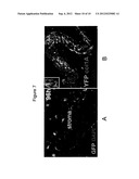 ADAM12 Inhibitors and Their Use Against Inflammation-Induced Fibrosis diagram and image