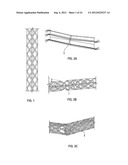 EXOTENSIONED STRUCTURAL MEMBERS WITH ENERGY-ABSORBING EFFECTS diagram and image