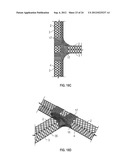 EXOTENSIONED STRUCTURAL MEMBERS WITH ENERGY-ABSORBING EFFECTS diagram and image