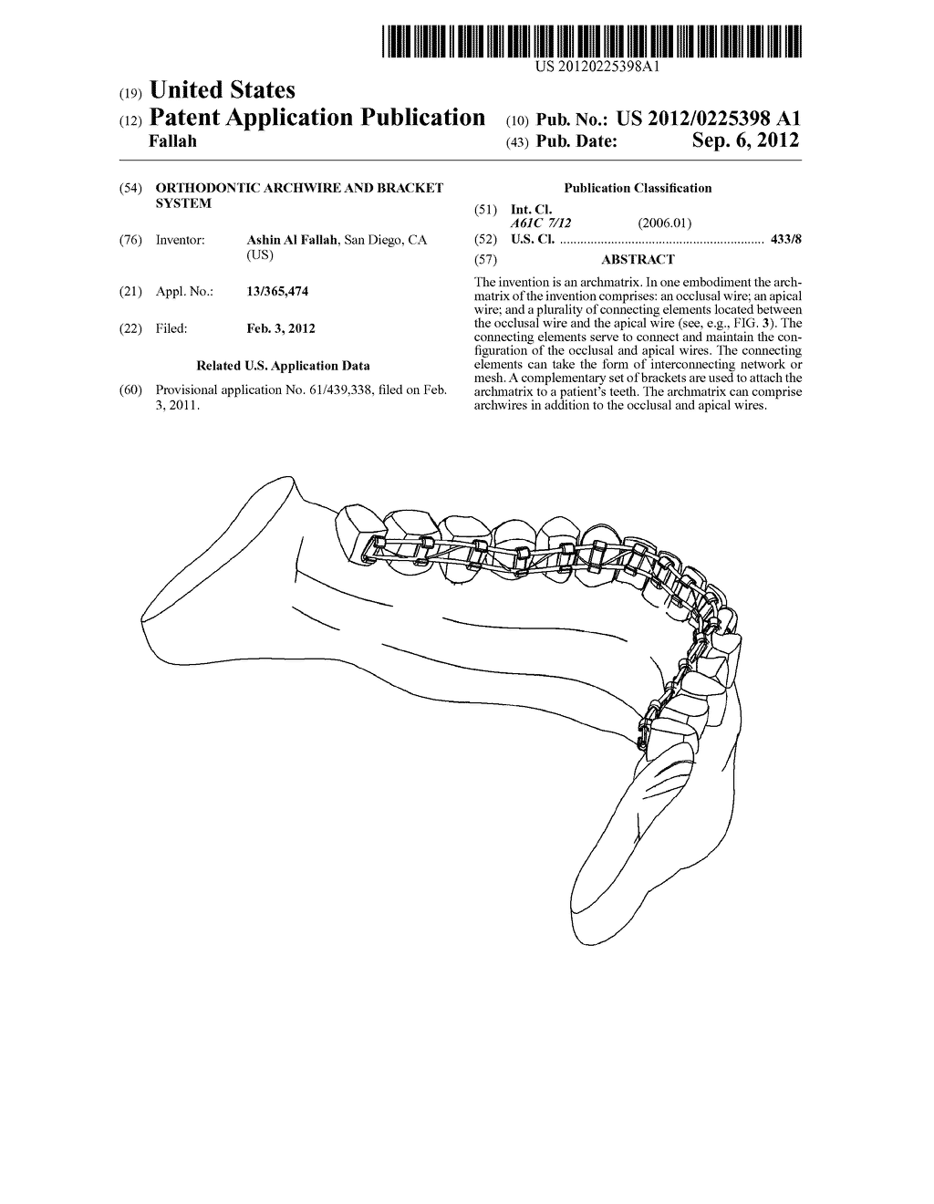 Orthodontic Archwire And Bracket System - diagram, schematic, and image 01