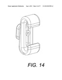 Orthodontic Archwire And Bracket System diagram and image