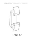 Orthodontic Archwire And Bracket System diagram and image