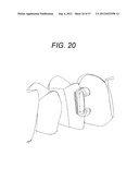 Orthodontic Archwire And Bracket System diagram and image