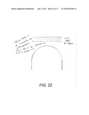 Orthodontic Archwire And Bracket System diagram and image