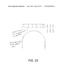 Orthodontic Archwire And Bracket System diagram and image