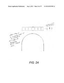 Orthodontic Archwire And Bracket System diagram and image