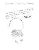 Orthodontic Archwire And Bracket System diagram and image