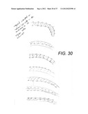 Orthodontic Archwire And Bracket System diagram and image