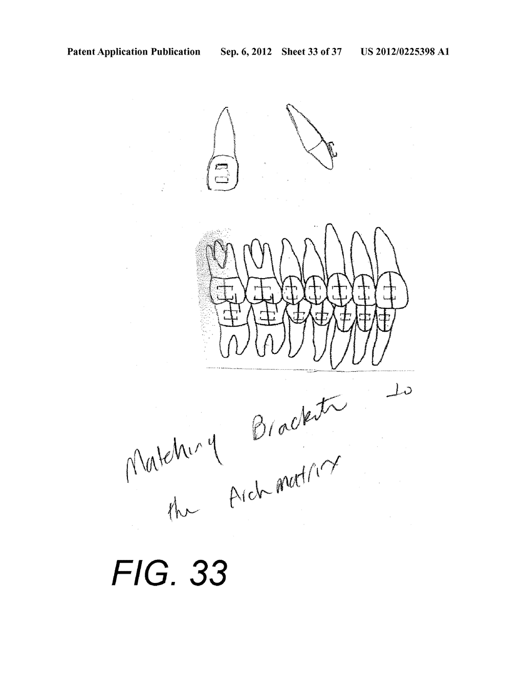 Orthodontic Archwire And Bracket System - diagram, schematic, and image 34